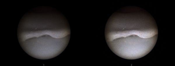 Comparison of image from endoscope before and after processing
